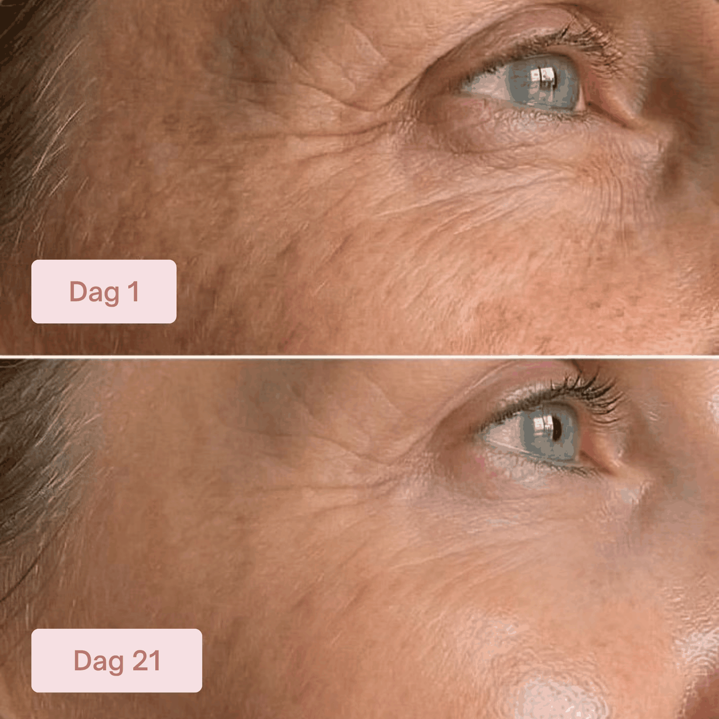 4-Set Salmon PDRN Collagen Mask