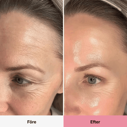 PDRN Collagen Volume Balm
